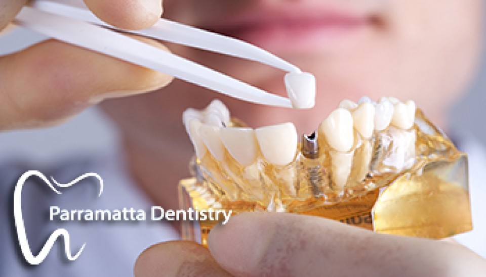 tooth-implant-cost-sydney-croozi